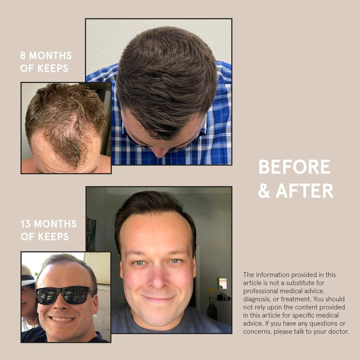 Keeps Hair Growth Shampoo and Conditioner Set - Treatment for Thinning Hair and Hair Regrowth - Men's Hair Products Infused with Biotin, Caffeine, &amp; Saw Palmetto Shampoo &amp; Conditioner Set Rieworkes
